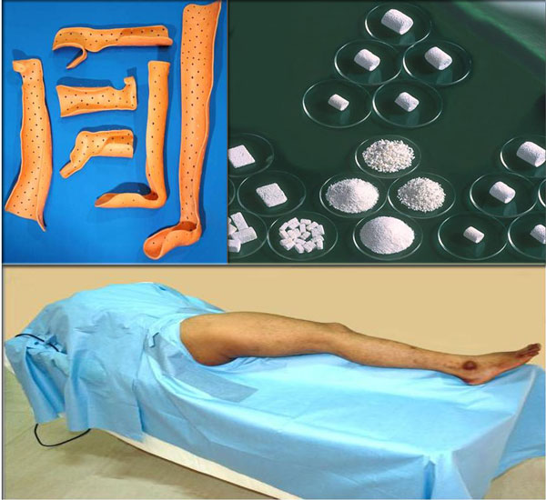 ORTHOPAEDIC PRODUCTS ORTHOPAEDIC PRODUCTS